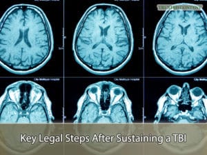 Key Legal Steps After Sustaining a TBI