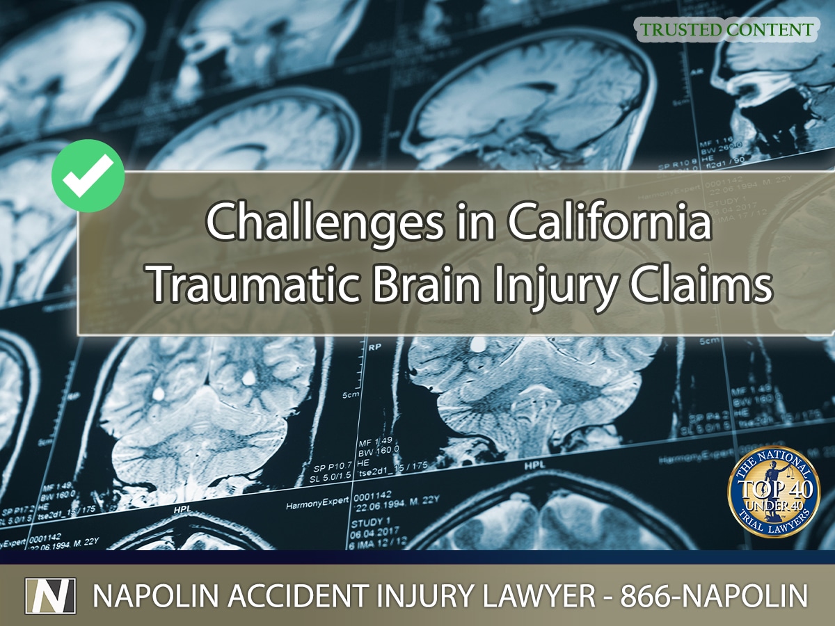 Overcoming Challenges in California Traumatic Brain Injury Claims – Technologist